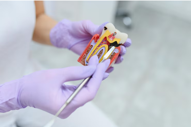 Emergency Root Canal Services in Al Ain – Where to Go for Quick Relief Emergency Root Canal Services in Al Ain – Where to Go for Quick Relief