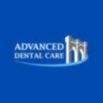 Dental Implants Brooklyn